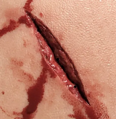 Trenażer pakowania rany "KNIFE STAB WOUND"