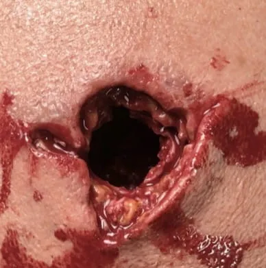 Trenażer pakowania rany "GUNSHOT WOUND"